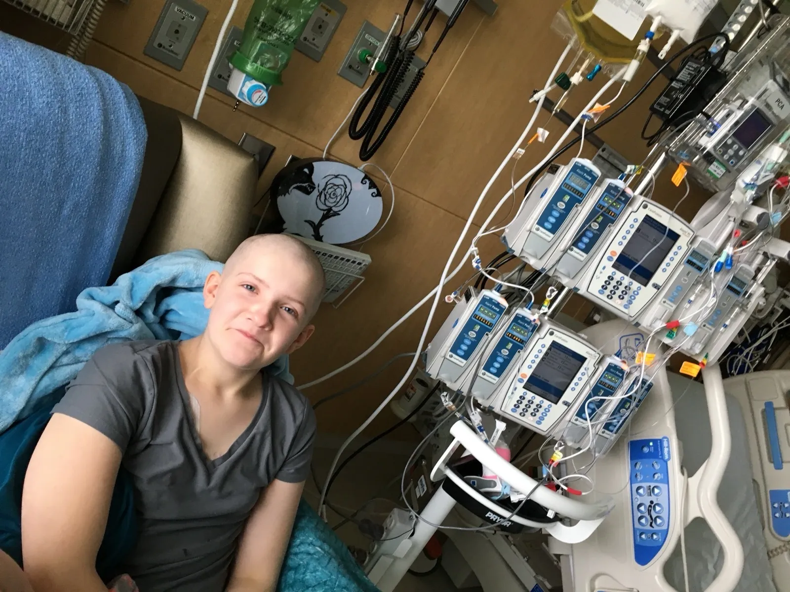Hailstone is seen without hair in a hospital room.