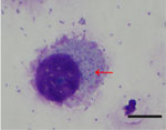 Microscopy of Orientia tsutsugamushi isolate Donan 18-3R detected and isolated from bat-associated Whartonia prima chiggers, Yonaguni Island, Japan. Giemsa-stained L929 cells 5 days after inoculation with fourth-passage Donan 18-3R, shows punctate, basophilic structures in the cytoplasm outside the nucleus, consistent with intracellular O. tsutsugamushi; the red arrow indicates representative intracellular bacteria. Oil immersion; scale bar represents 10 µM. 