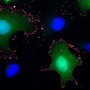 PCDH1